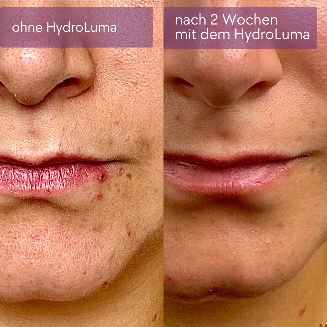 HydroLuma | elektrische 4-in-1 Gesichtsreinigungsbürste